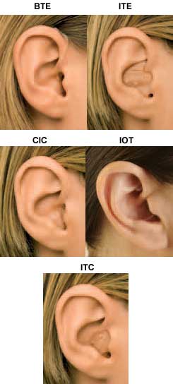 Types of Hearing Aids